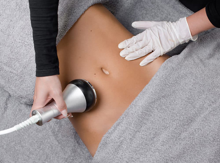 Lipocavitation - radiofréquence